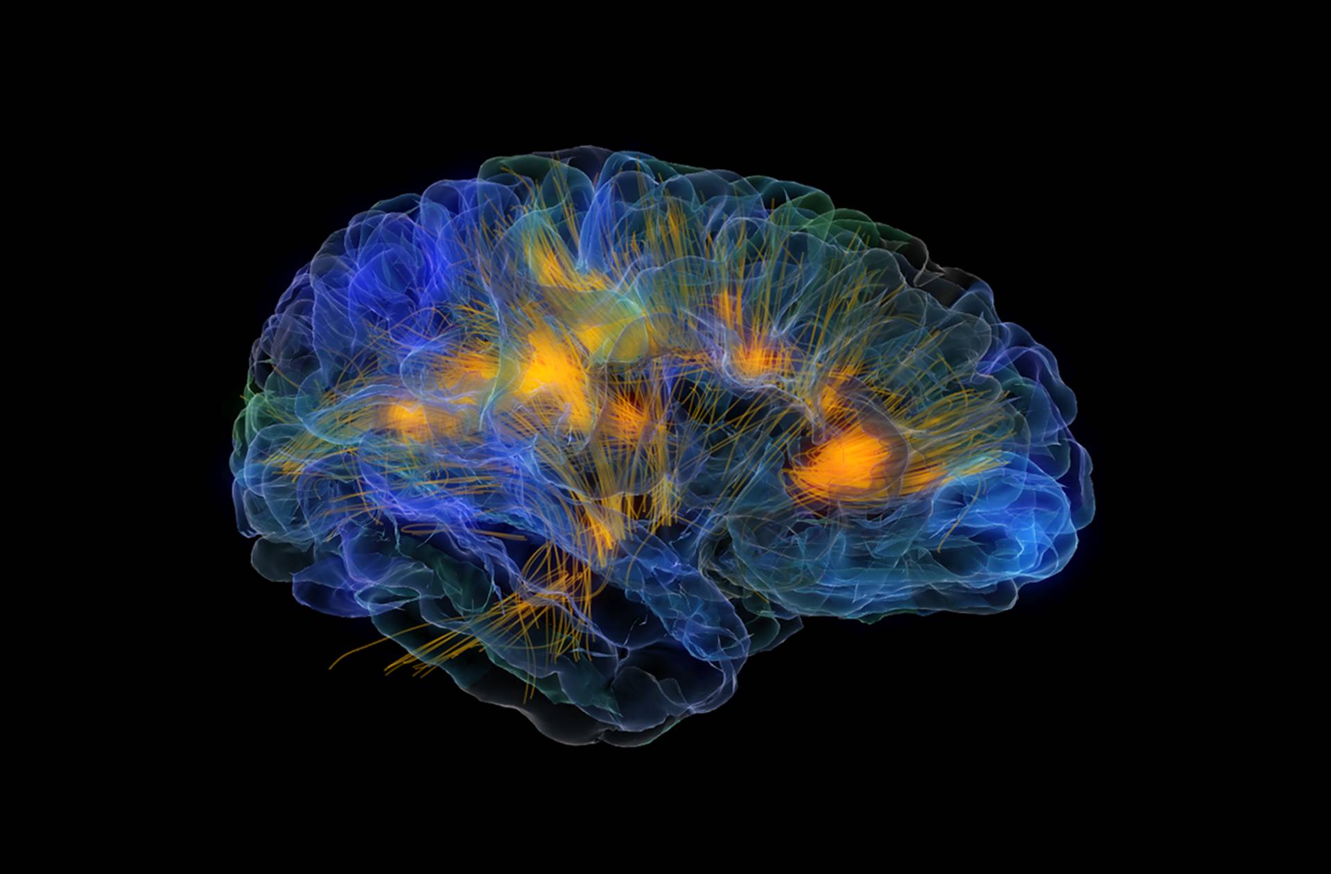 Brain imaging. Красивый мозг.