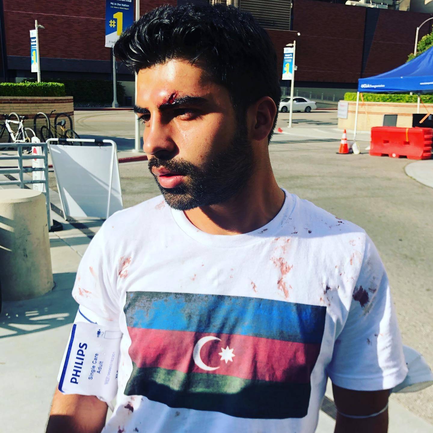 Los Ancelesdə ermənilər azərbaycanlı nümayişçilərə hücum edib 4 nümayiş2